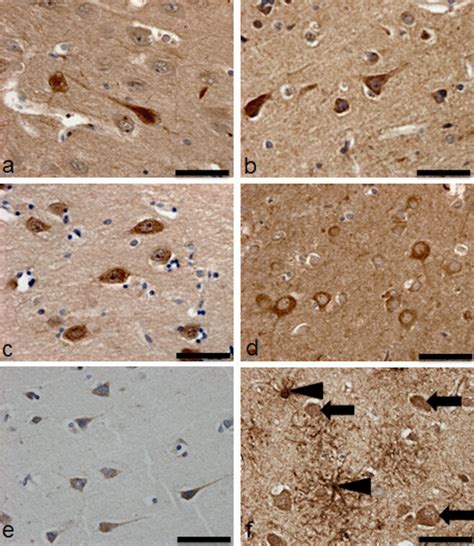 Immunohistochemical Assessment Of Protein Expression Encoded By