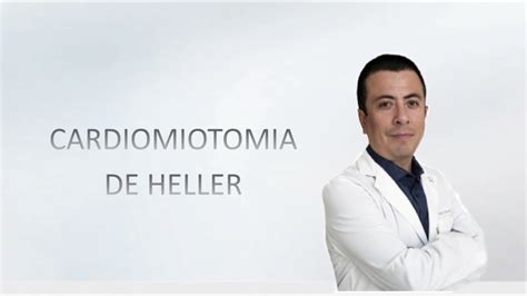Cardiomiotomia A Heller - CARDIOMIOTOMIA DE HELLER- Dr. Edgar Villanueva - YouTube