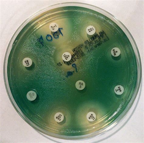 The antibiogram of P. aeruginosa on Mueller-Hinton agar Plant Science ...