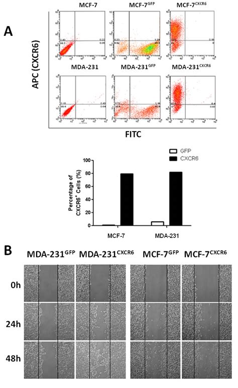 Cxcl16 Cxcr6 Chemokine Signaling Mediates Breast Cancer Progression By