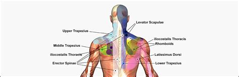 Relieving Pain With Trigger Point Injections A Comprehensive Guide