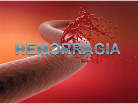 Hemorragia Ppt