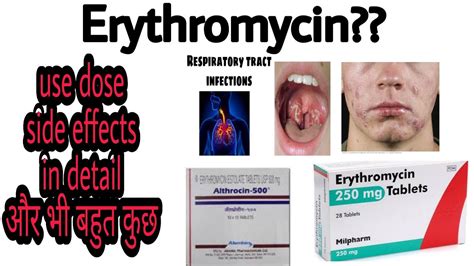 Althrocin 500 Mg Tablet Erythromycin Tablet Erythromycin Stearate