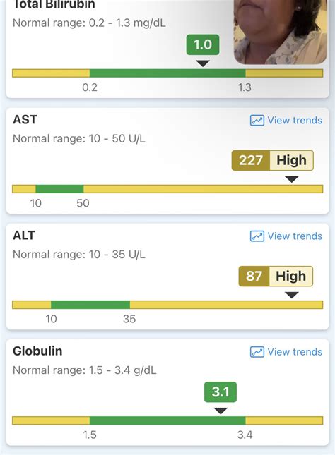 High ast and alt levels? : r/AskDoctorSmeeee