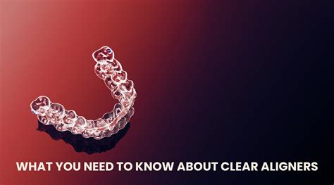 Clear Aligner Insights Your Guide To Starting Treatment