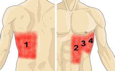 21 Best Rib pain ideas | rib pain, trigger points, pain