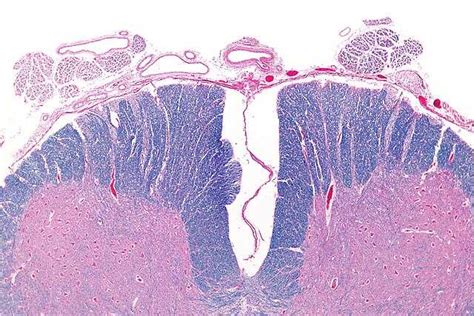 Arteria Espinal Anterior Wikiwand