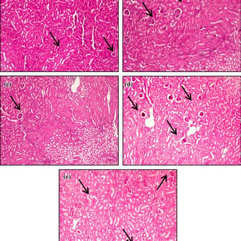 Histopathological Assessment Of Colon In Different Groups A