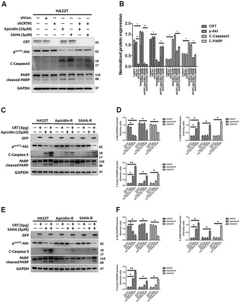 Calreticulin Nuclear Translocalization Alleviates CaM CaMKII CREB