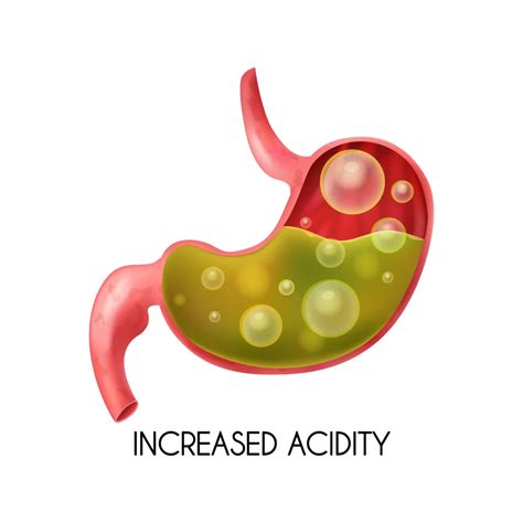 Acidity - Shree Ganga Hospital