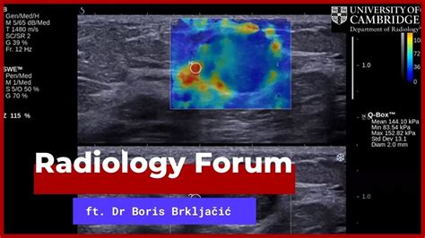 “multiparametric Breast Ultrasound” By Dr Boris Brkljačić Youtube