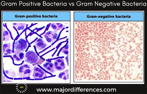 E Coli Gram Positive or Negative - Melina-has-Oneal