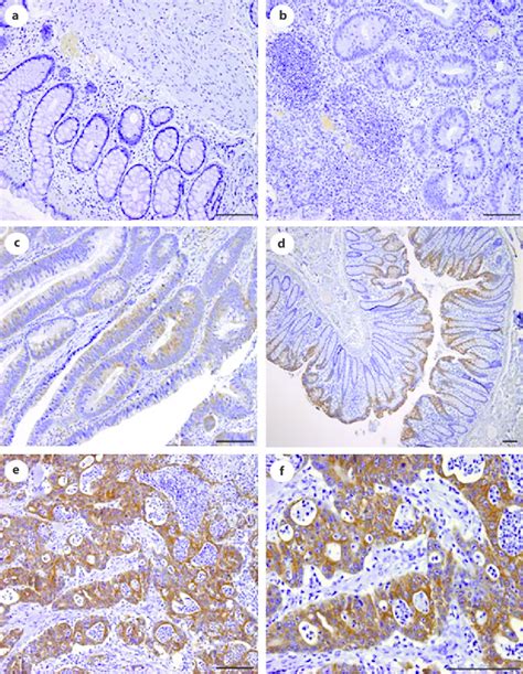 Immunohistochemical Expression Of CDw75 Sections From A Healthy