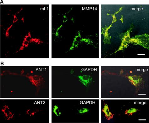 Ant And Ant Colocalize With Gadph And L Colocalizes With Mmp At