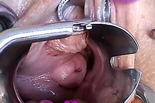 Vagina Contractions Masturbation Pussy Speculum Wide Gaping CLPorn