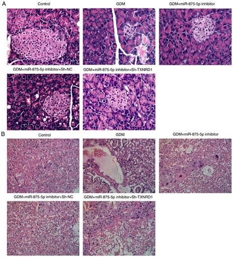 Txnrd Knockdown Reverses The Effects Of Mir P Inhibitor On