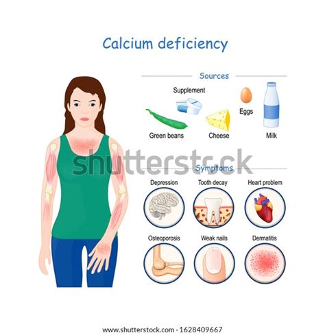 Calcium Deficiency Sign Symptoms Ca Deficiency Stock Vector Royalty Free 1628409667 Shutterstock