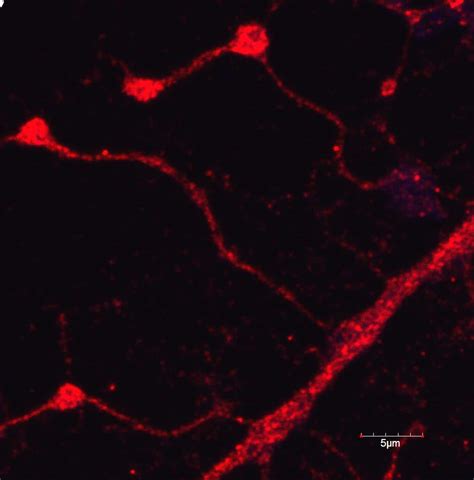 Rat Cx Cl Fractalkine Chemokine Domain Antibody Af R D Systems