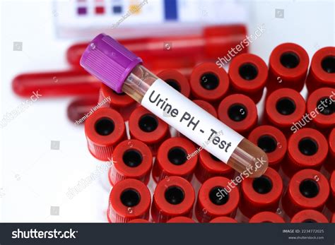 Urine Ph Test Look Abnormalities Urine Stock Photo 2234772025 ...