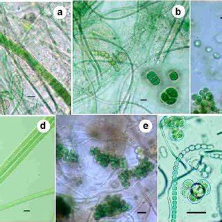 Cyanobacterial diversity in the samples (a-f). a. Phormidium sp., and... | Download Scientific ...