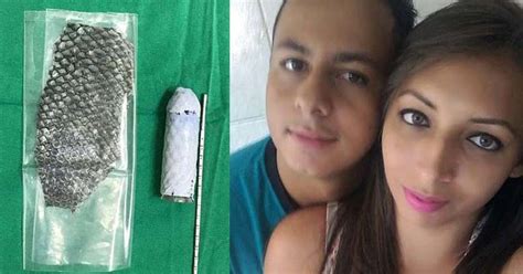 Nació sin vagina y le construyeron una con piel de pescado