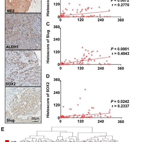 High Expression Levels Of Aldh1 Sox2 Slug And Me2 In Oscc Tissues