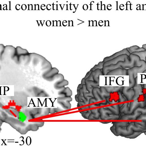 1 Column Women Had A Stronger Functional Connectivity Of The Left