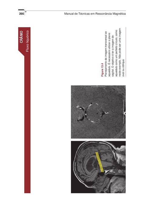 Manual De Técnicas Em Ressonância Magnética By Editora Rubio Issuu