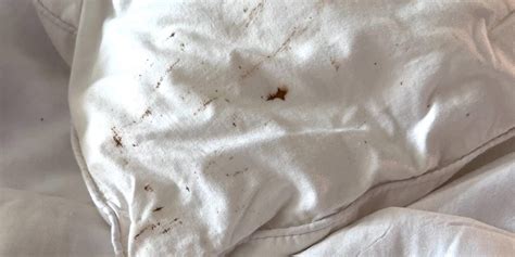 8 Early Signs Of Bed Bugs Pestend Pest Control London Ontario