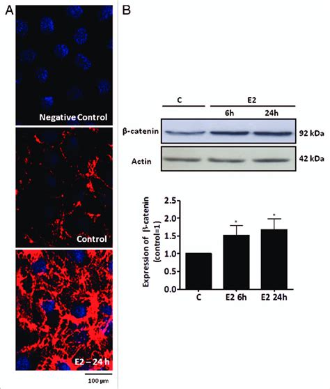 Expression Of β Catenin In A Primary Culture Of Sertoli Cells From