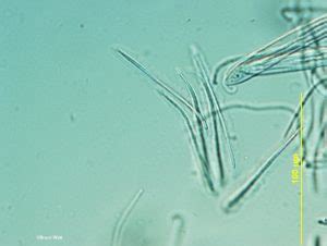 Pine - Lophodermium Needle Blight - Cooperative Extension: Insect Pests, Ticks and Plant ...