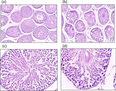 Histopathology Image Of The Testis Showing Seminiferous Tubule Of A