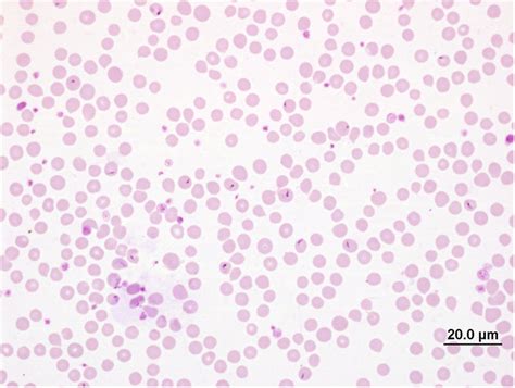 Giemsa Stained Blood Smear Showing Piroplasms Of Theileria Orientalis