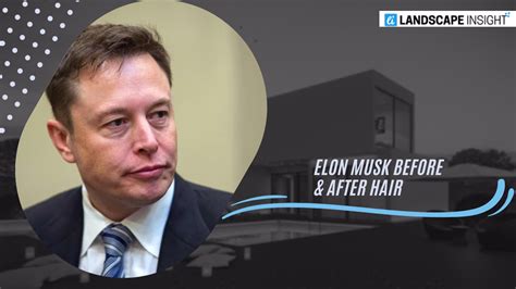 Elon Musk Before & After Hair: Everything You Need To Know!