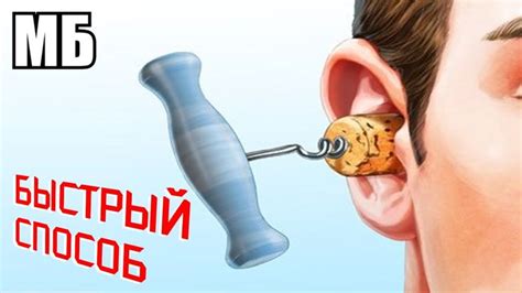 Заложило ухо | Как быстро и легко избавится от ушной пробки | Лайфхак
