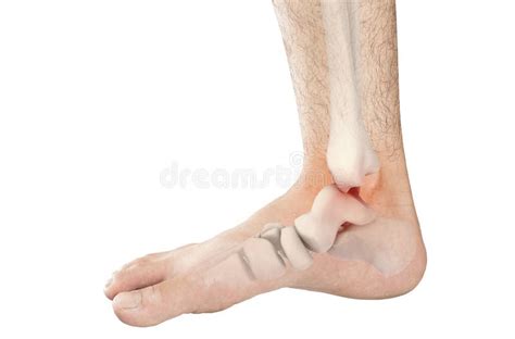 Foot bones pain stock image. Image of metatarsal, foot - 122486079