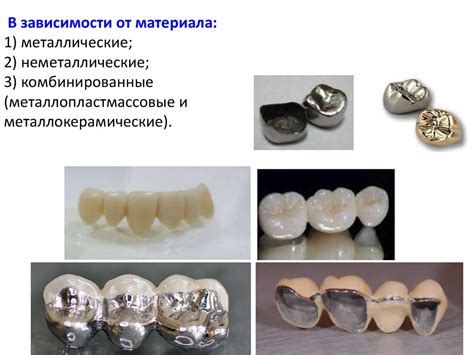 Искусственные коронки. Штампованная и цельнолитая металлические коронки ...