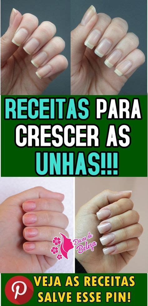 As Receitas Naturais Para Acelerar O Crescimento Das Unhas Unhas