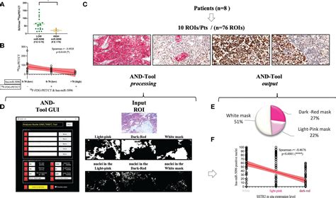 Frontiers Circulating Hsa MiR 5096 Predicts 18F FDG PET CT Positivity