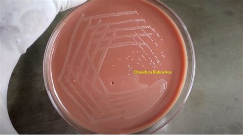 Chocolate Agar Introduction Composition Principle Preparation