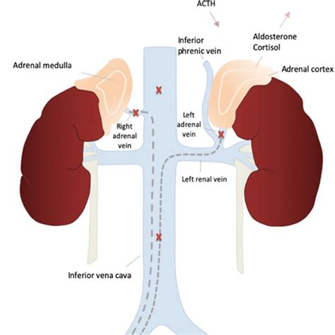 Adrenal Vein Anatomy