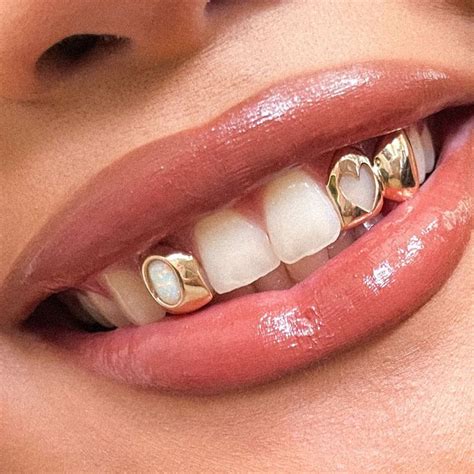 Opal Gold Grillz For Stylish Men And Women