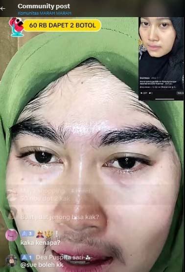 Viral Wajah Wanita Ini Tumbuh Bulu Usai Pakai Skincare Apa Saja