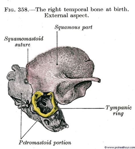 Temporal Bones Prohealthsys