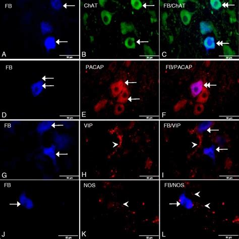 A Fb Labeled Neurons Arrows In The Porcine Control Dmx B Chat Ir