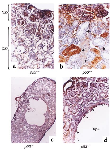 P53 Deficient Mice Have Abnormal Kidneys A Kidney Tissue Section