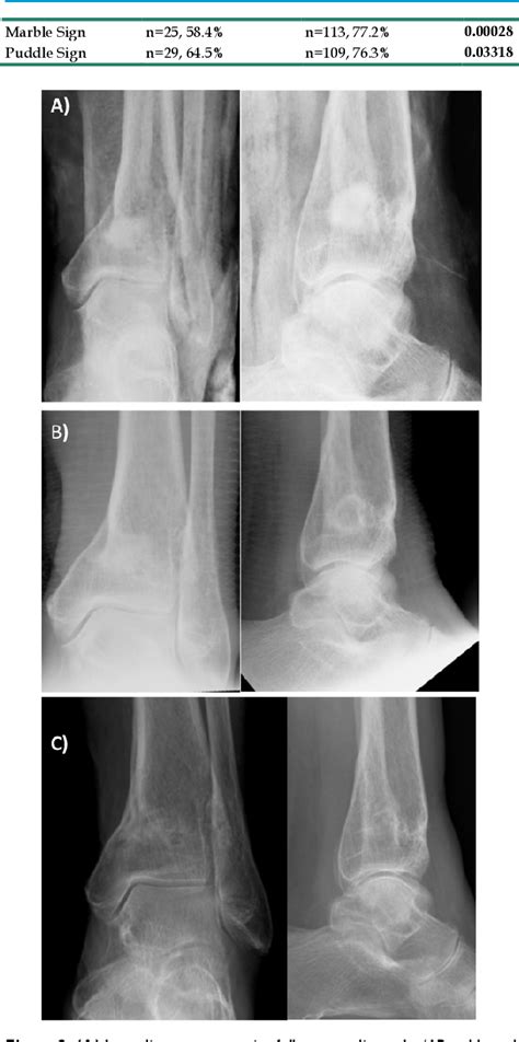 Figure 2 From Radiographic And Histological Analysis Of A Synthetic