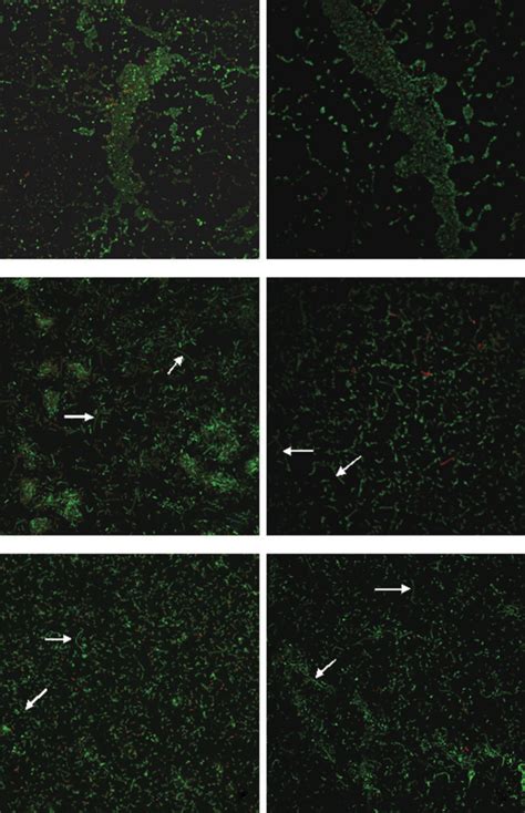 Confocal Laser Scanning Micrographs Illustrating The Viability Of E