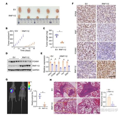 JCI insight陆军军医大学新桥医院胡长江 杨仕明团队发现靶向RNF112 FOXM1信号的抗胃癌新策略 知乎