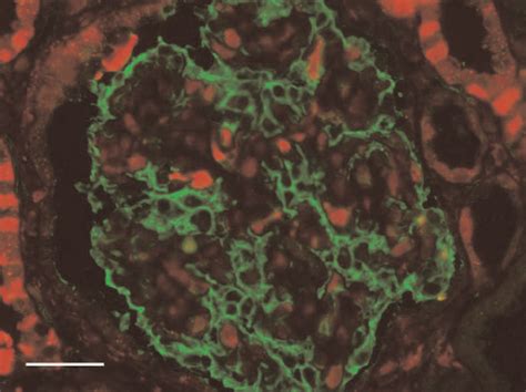 Double Incubation Of Galectin Red And Podocalyxin Green In